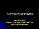 Reactive and Undifferentiated Spondyloarthropathies…are they the