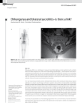 Chikungunya and bilateral sacroiliitis–is there a link?