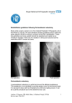 Rehabilitation guidelines following Periacetabular osteotomy