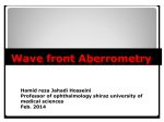 Wave front Aberrometry