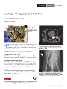 Horner Syndrome at a Glance