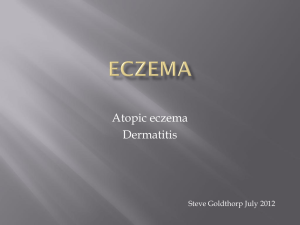 Atopic eczema Dermatitis