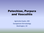 Petechiae, Purpura and Vasculitis