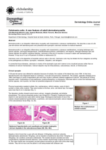 Calcinosis cutis: A rare feature of adult dermatomyositis