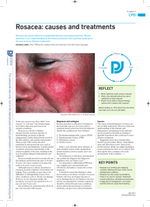 Rosacea: causes and treatments