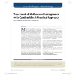 Treatment of Molluscum Contagiosum with Cantharidin