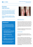 Eczema - SouthDerm