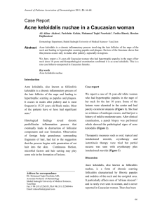 Acne keloidalis nuchae in a Caucasian woman - JPAD