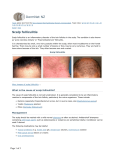 Scalp Folluculitis - Sun City Dermatology