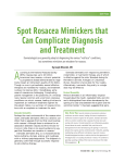 Spot Rosacea Mimickers that Can Complicate Diagnosis