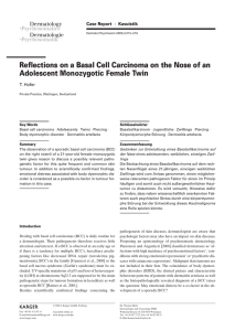 Reflections on a Basal Cell Carcinoma on the Nose of an