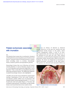 Palatal ecchymosis associated with irrumation