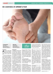 An overview of athlete`s foot