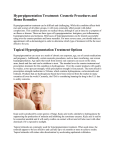Hyperpigmentation Treatment: Cosmetic Procedures and Home