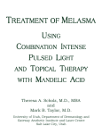 Treatment Of Melasma