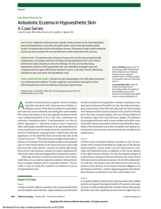 Asteatotic Eczema in Hypoesthetic Skin: A Case Series