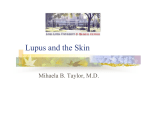 Lupus and the Skin