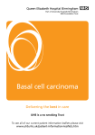 Basal cell carcinoma - University Hospitals Birmingham NHS