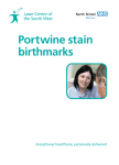 Portwine stain birthmarks