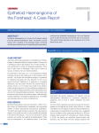 Epitheloid Haemangioma of the Forehead: A Case Report