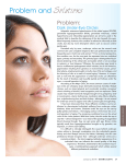 Problem and Solutions Problem: Dark Under-Eye Circles