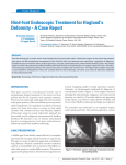 Hind-foot Endoscopic Treatment for Haglund`s Deformity