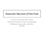 Avascular necrosis of the foot