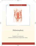 Abdominoplasty - Lorne K. Rosenfield