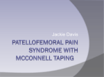 Patello-Femoral Pain Syndrome with McConnell Taping