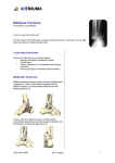 Malleolar fractures