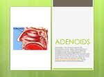 adenoids - ENT Lectures