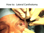 How to: Lateral Canthotomy