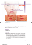 Nasolabial Folds