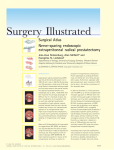 Surgical Atlas Nerve-sparing endoscopic