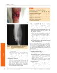 Requirements for Tetanus Prophylaxis Immunization History dT TIG