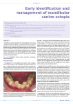Early identification and management of mandibular canine ectopia