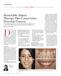 Removable Aligner Therapy Plus Conservative Porcelain Veneers