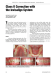 Class II Correction with the Invisalign System - Schupp