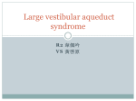 Large vestibular aqueduct syndrome