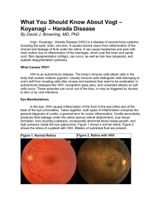 Koyanagi – Harada Disease