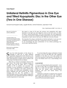 Unilateral Retinitis Pigmentosa in One Eye and Tilted Hypoplastic