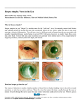 Herpes simplex virus conditions in the eye