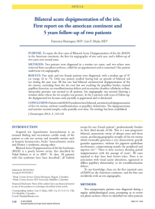 Bilateral acute depigmentation of the iris. First report