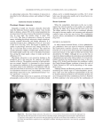749 or a physiologic anisocoria. The evaluation of anisocoria is