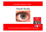 Session 3 – Visual Acuity