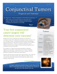 Conjunctival Tumors - New York Eye and Ear Infirmary