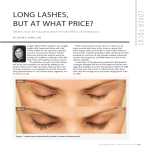 long lashes, but at what price?