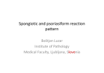 Spongiotic and psoriasiform reaction pattern