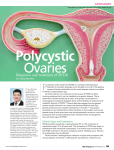 Diagnosis and treatment of PCOS