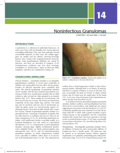 Noninfectious Granulomas